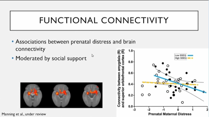 Lecture slide from Catherine Lebel showing association between prenatal distress and brain connectivity