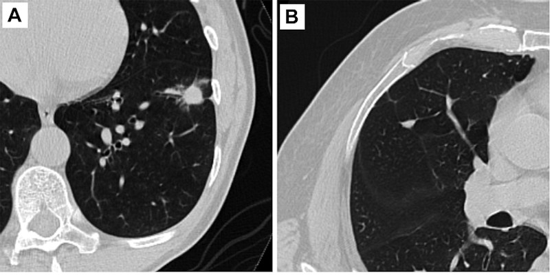 Examples of axial CT images of pulmonary nodules included in the multicenter reader study